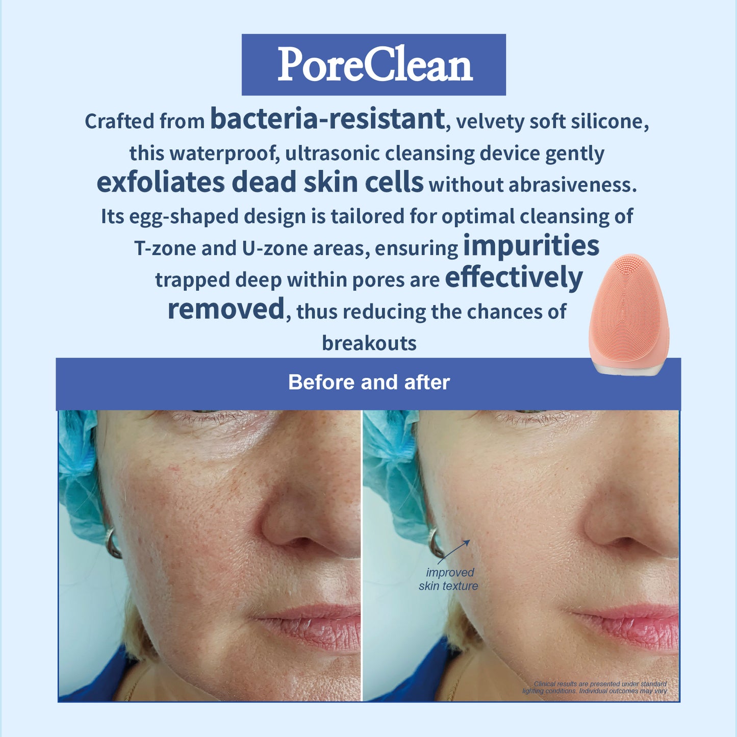 Pore Clean